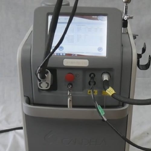 2017 Candela GentleMax Pro Laser